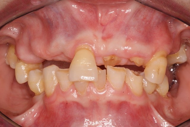 Before treatment